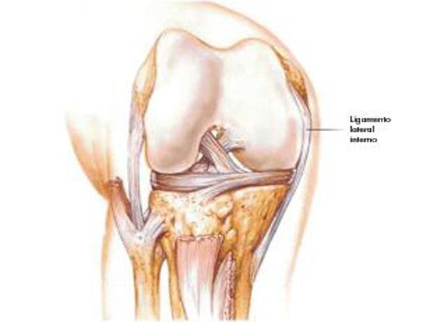 Rehabilitación y Fisioterapia - Existen lesiones del vasto externo del  muslo, las cuales pueden provocar inflamación de moderada a severa, con  incapacidad para la locomoción y función de rodilla, es necesario aplicar
