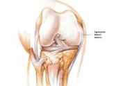 La recuperación del esguince de rodilla